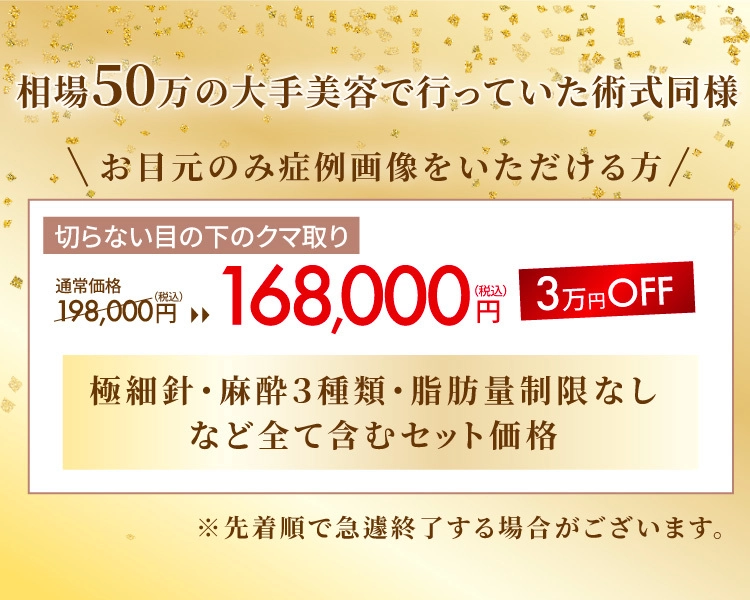 お目元のみ症例画像をいただける方！3万円OFF