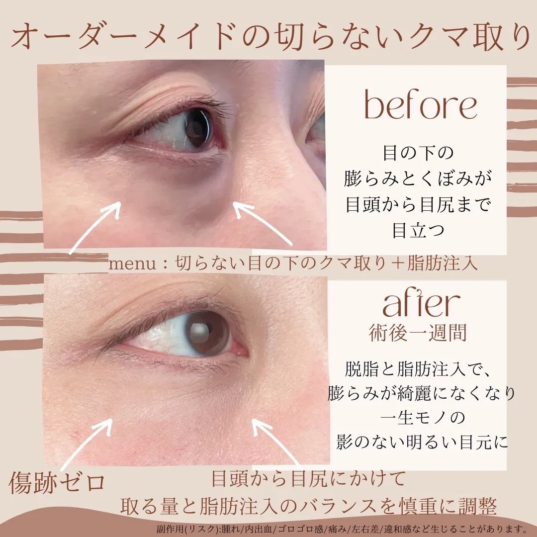 before・after画像