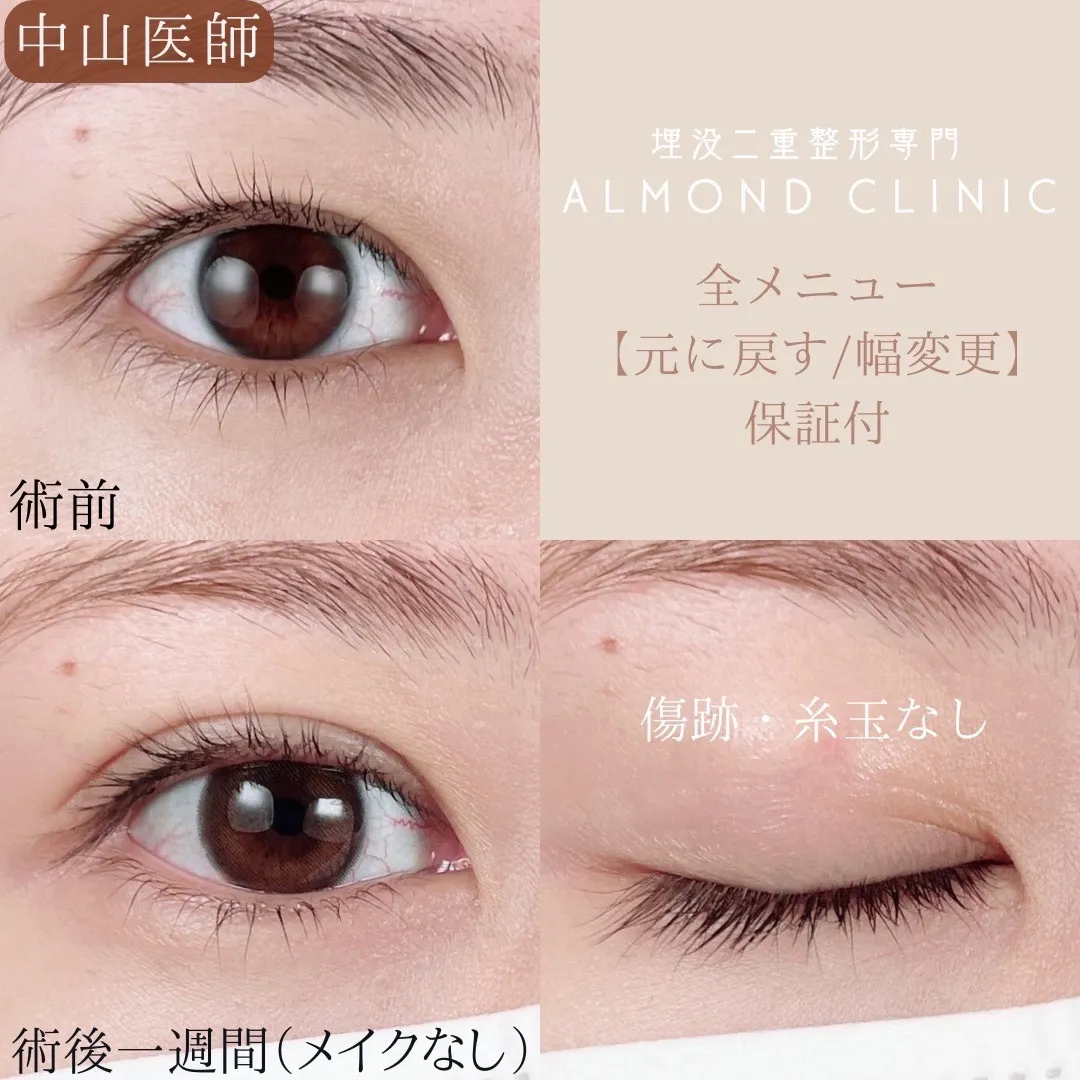 before・after画像