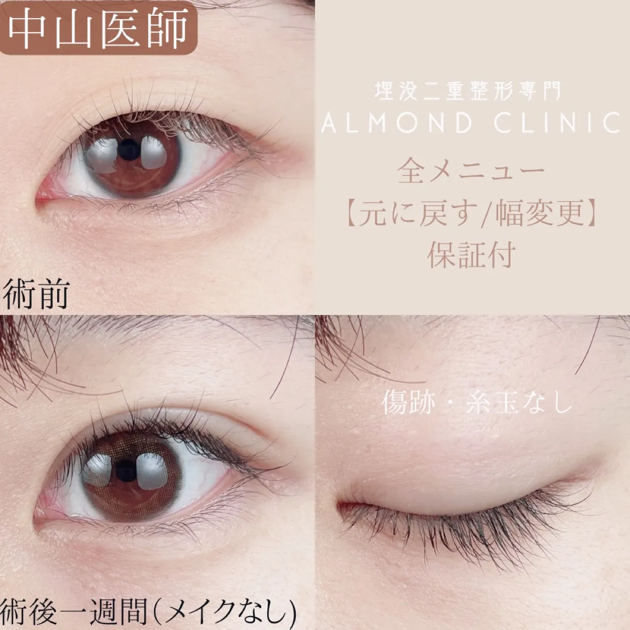 before・after画像