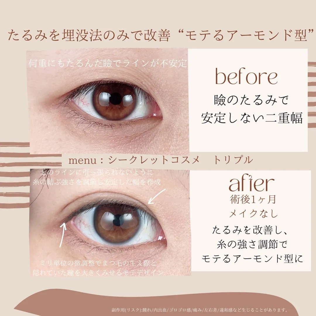 before・after画像