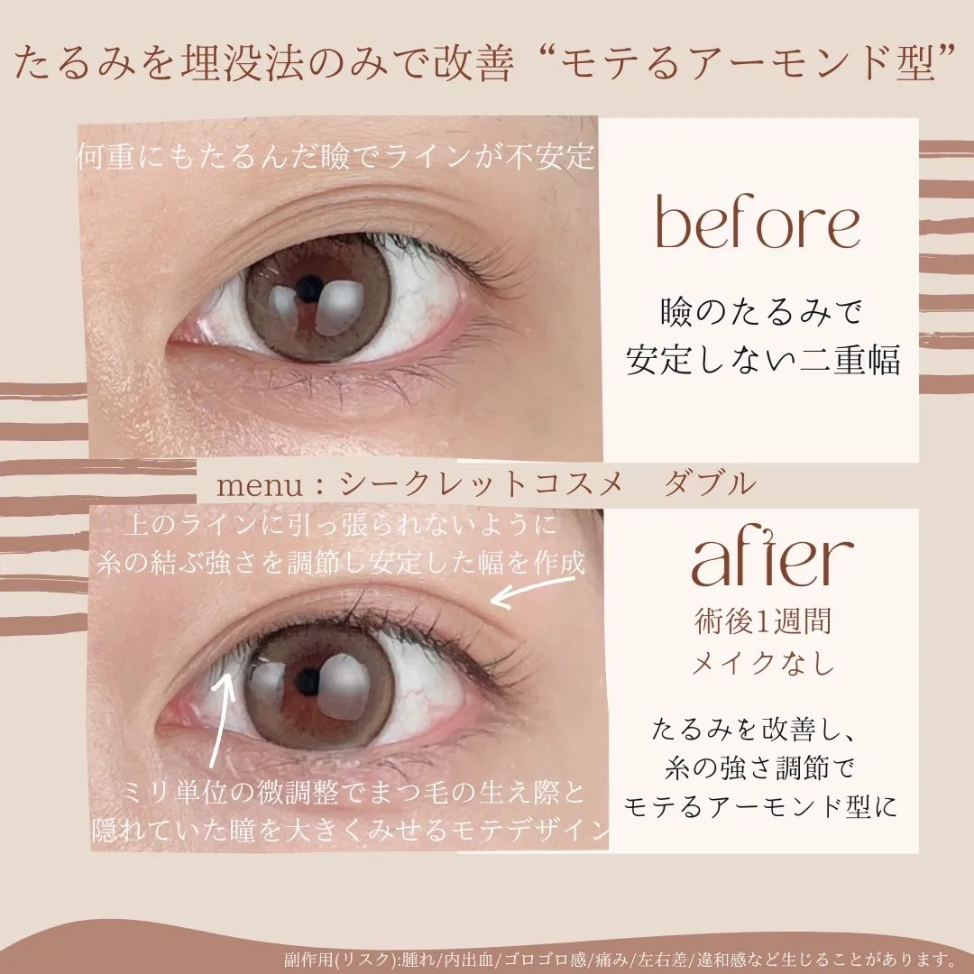 before・after画像
