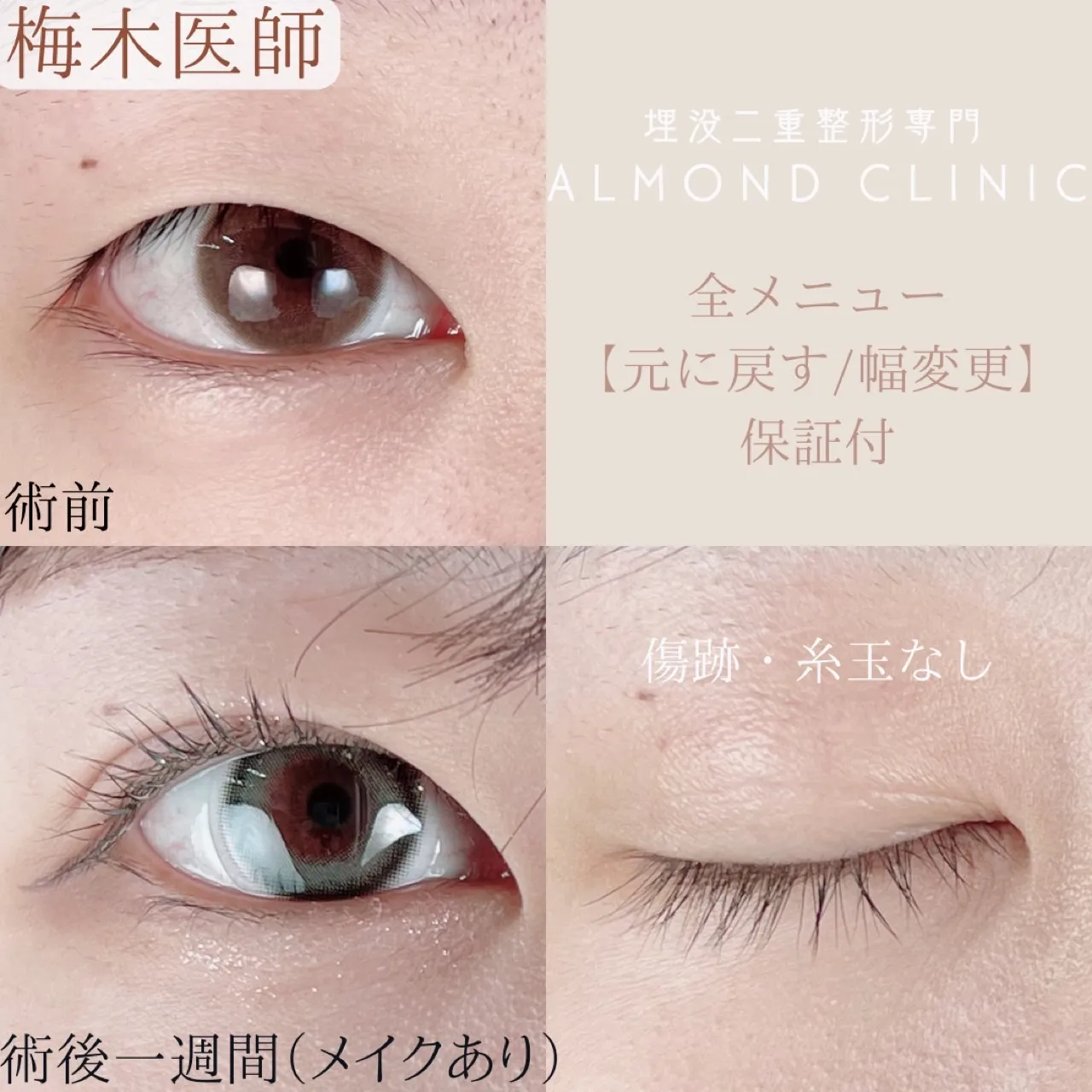 before・after画像