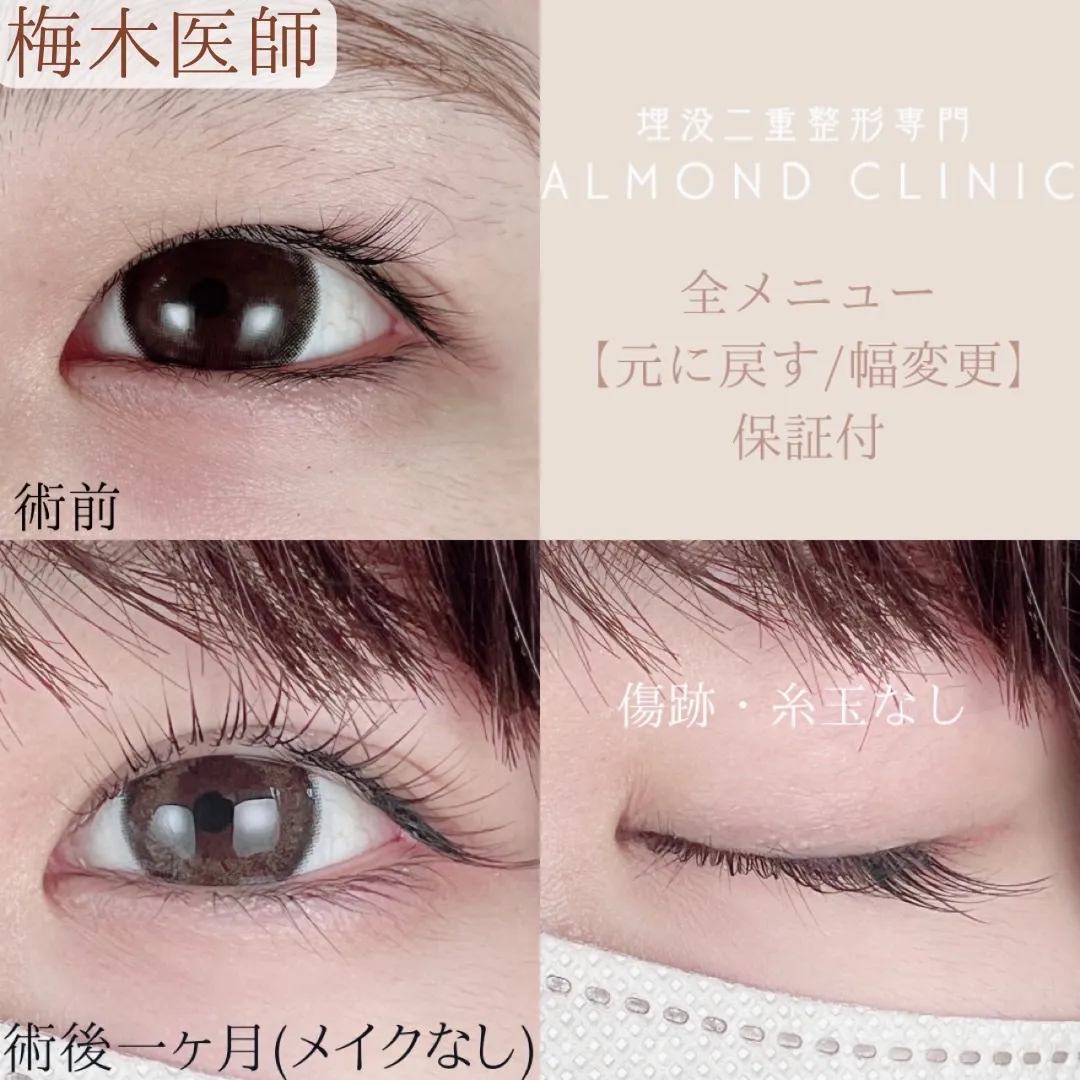 before・after画像