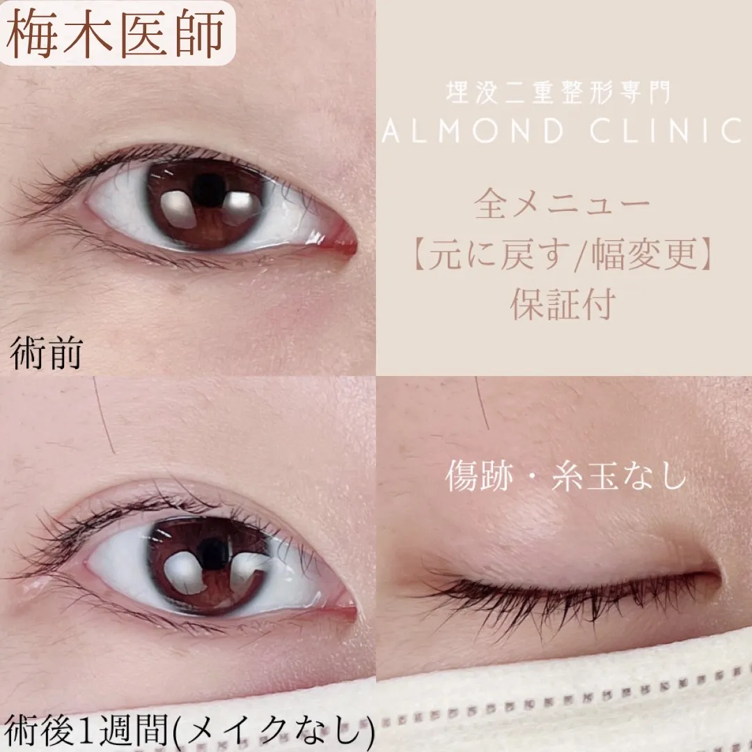 before・after画像