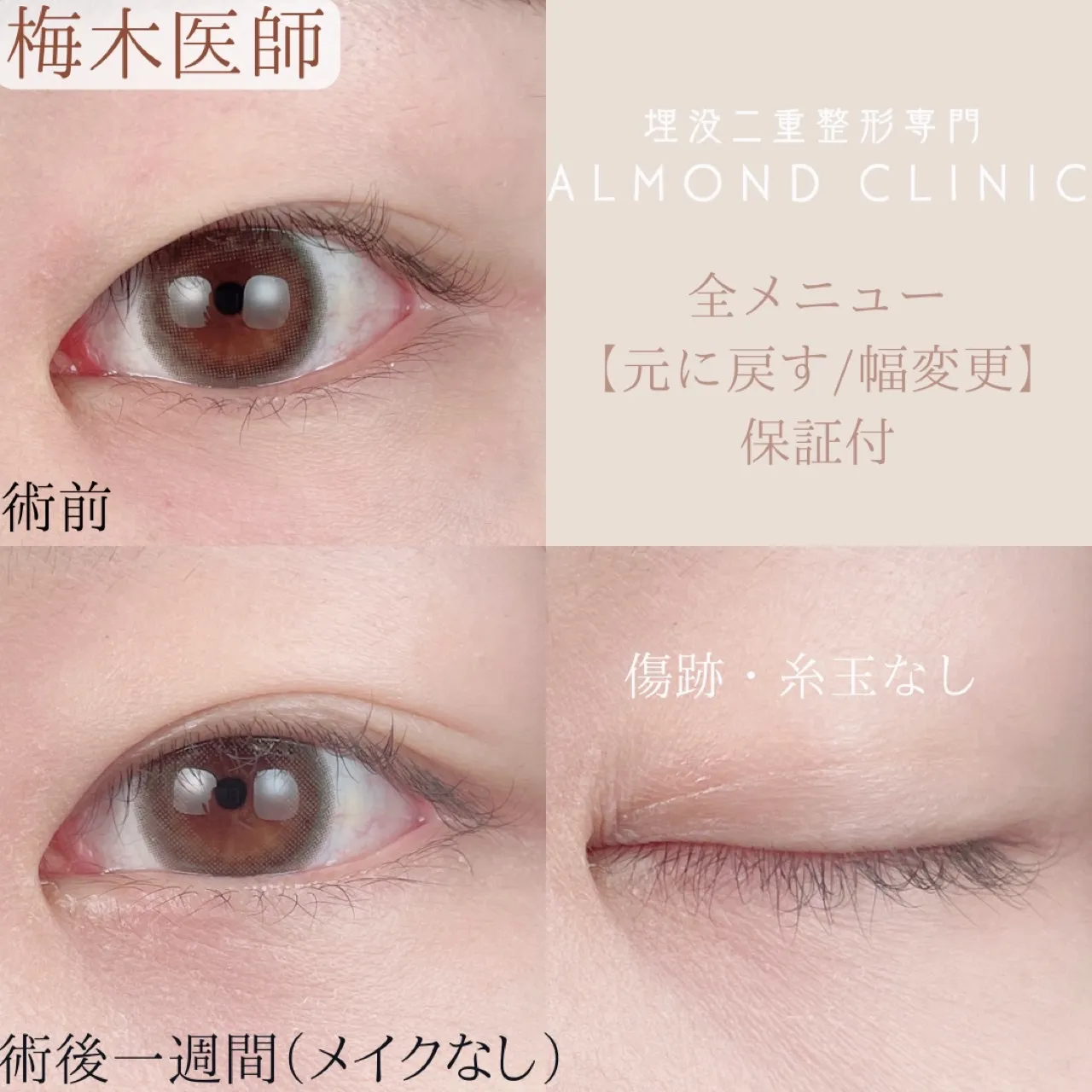 before・after画像
