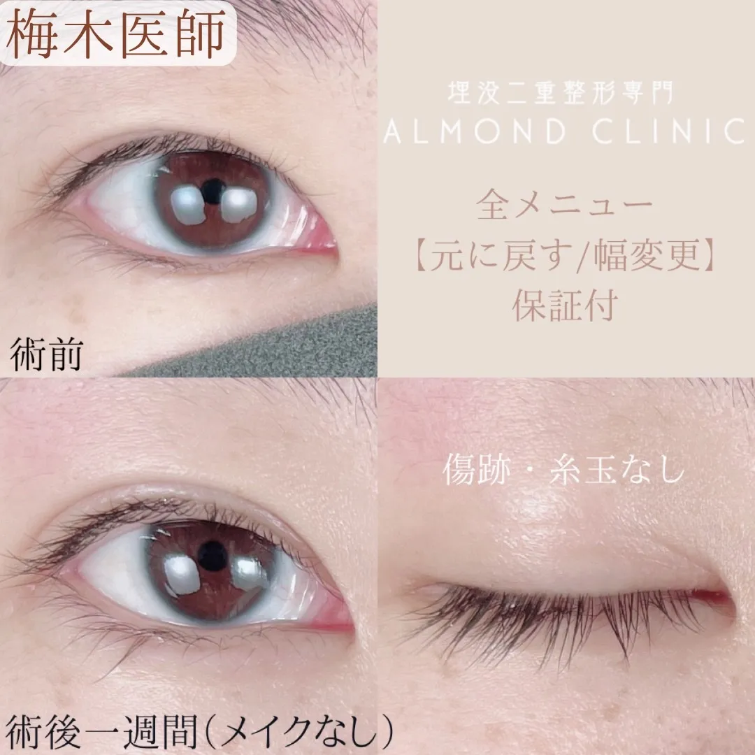 before・after画像