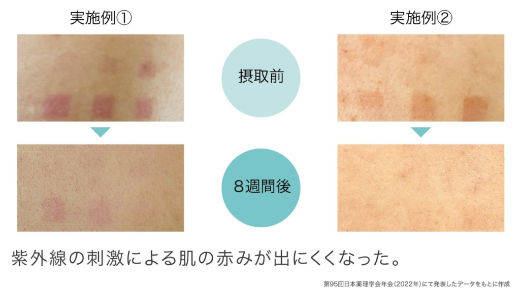 飲む日焼け止めを飲み続けた場合の実施例画像1