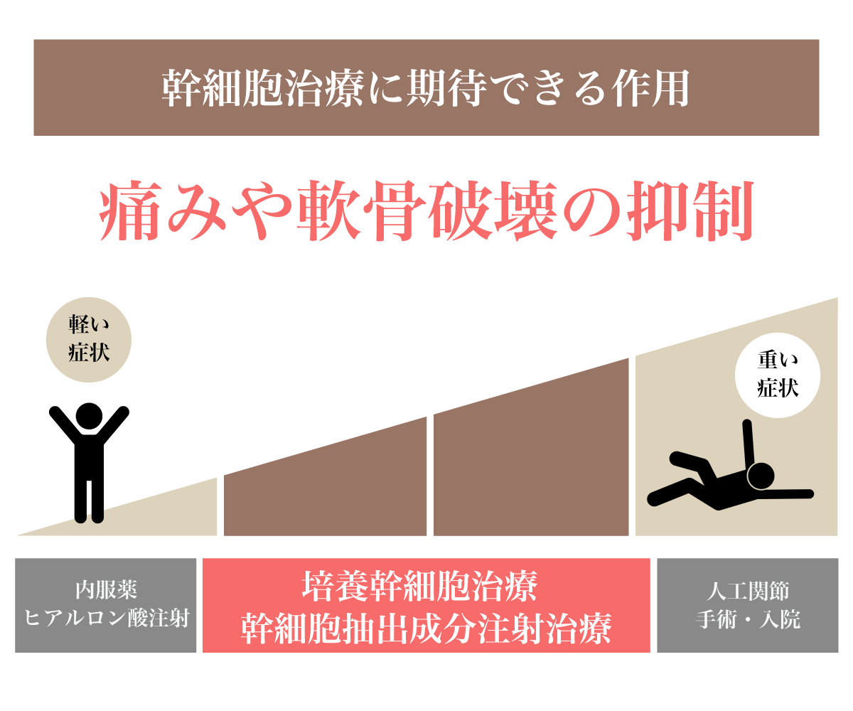 幹細胞治療に期待できる作用　痛みや軟骨破壊の抑制