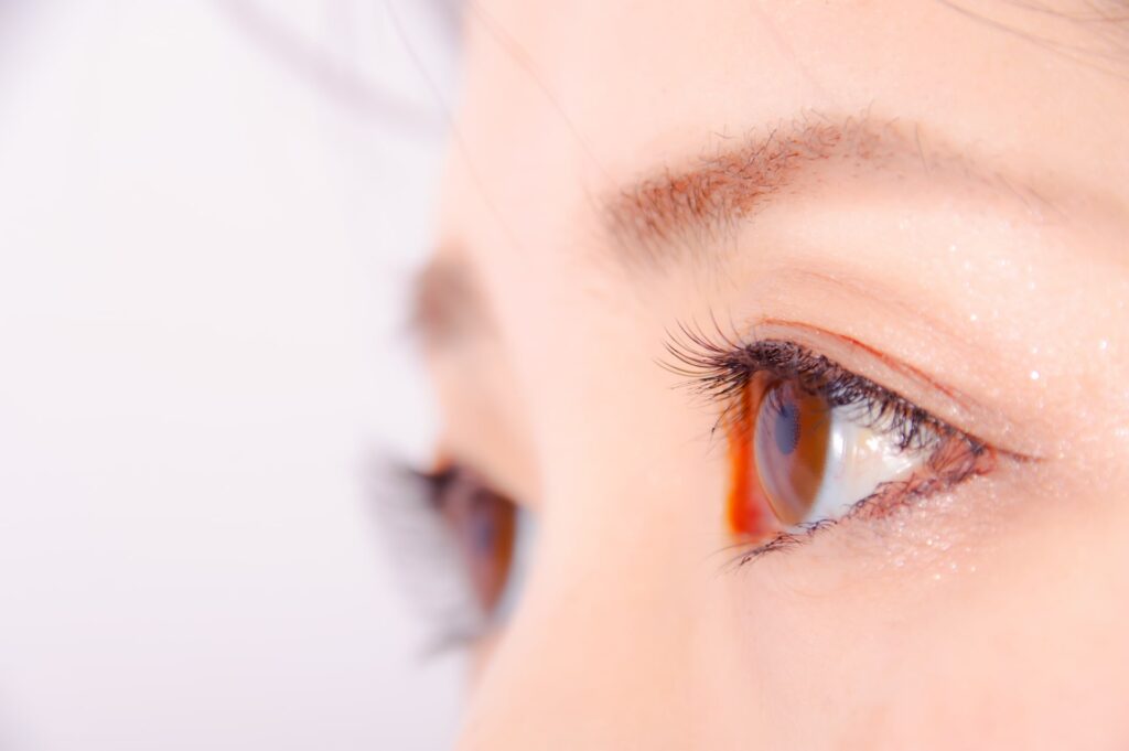 ボトックス注射の失敗例を部位毎に紹介