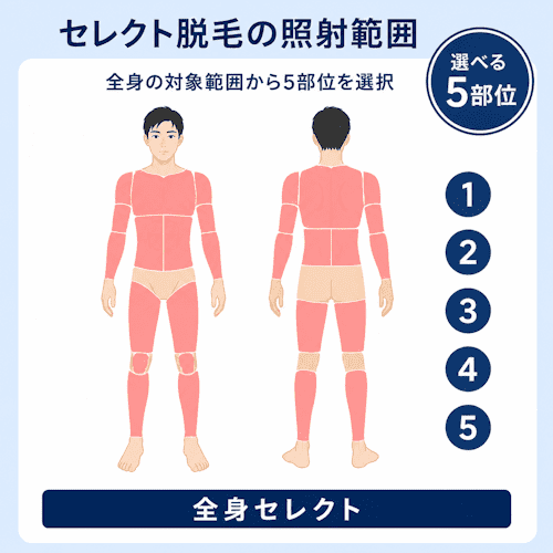 レジーナクリニックオムのセレクト脱毛プランの照射範囲