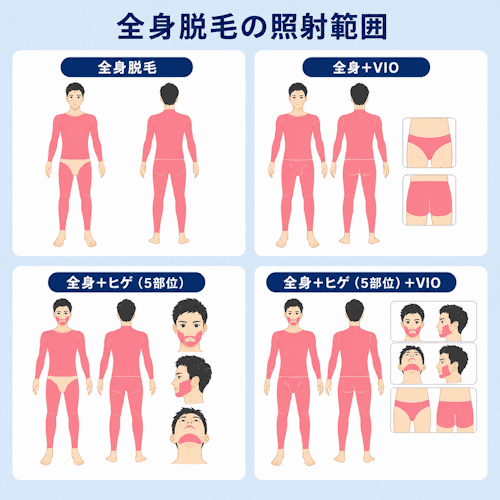 レジーナクリニックオムの全身脱毛プランの照射範囲