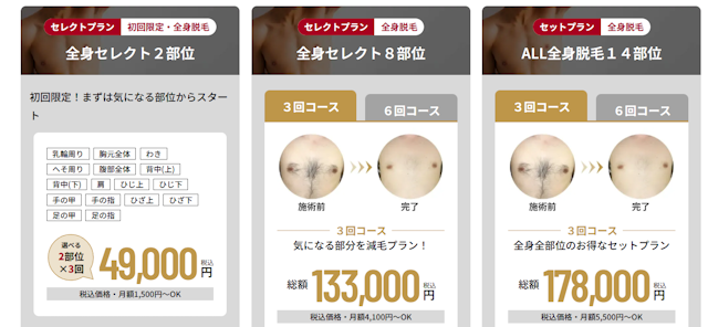RINX全身脱毛料金