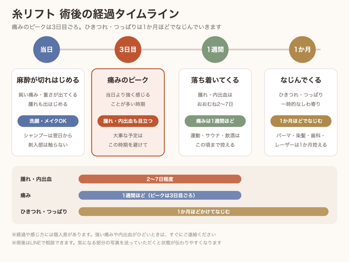 糸リフトの術後の経過タイムライン