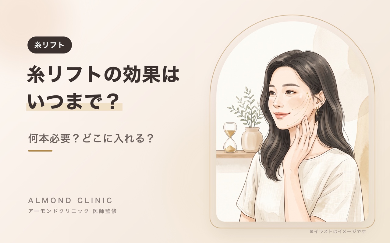 糸リフトの効果はいつまで?何本必要?どこに入れる?