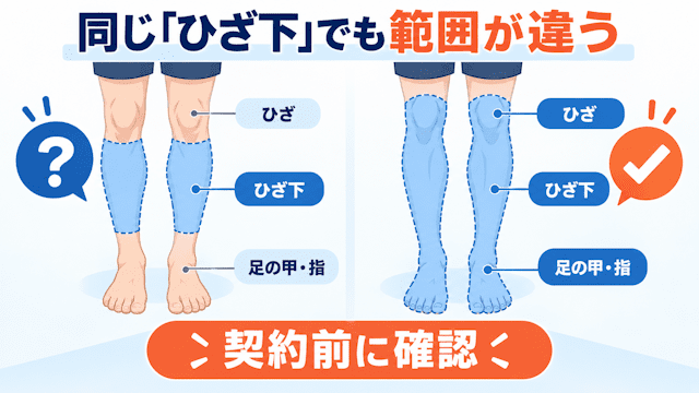 メンズ脚脱毛は対象範囲を確認
