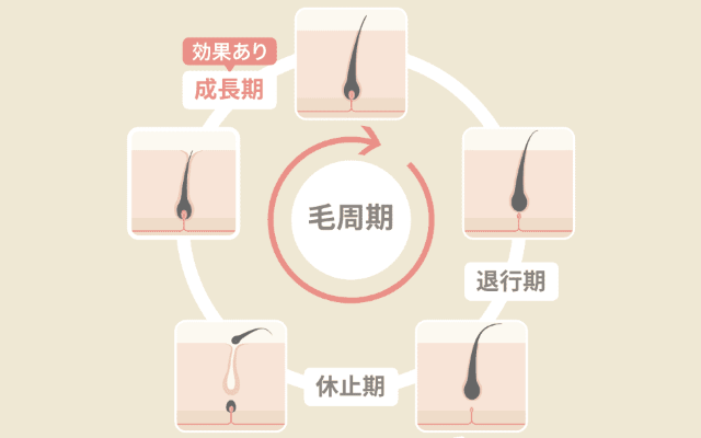 毛周期 リゼ