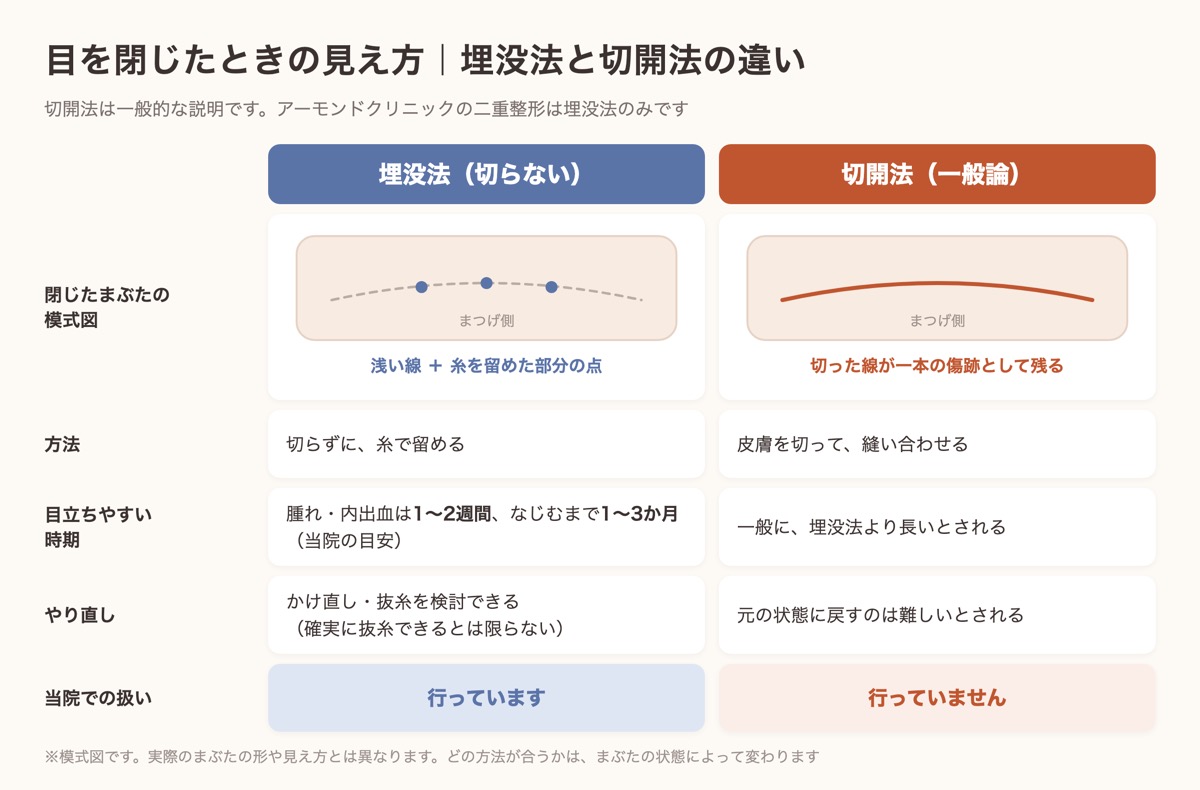 目を閉じたときの見え方を埋没法と切開法で比べた模式図と比較表