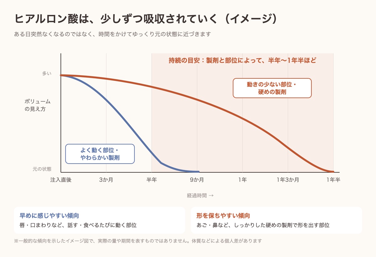ヒアルロン酸が時間をかけて少しずつ吸収されていくイメージ図。持続の目安は製剤と部位によって半年〜1年半ほど