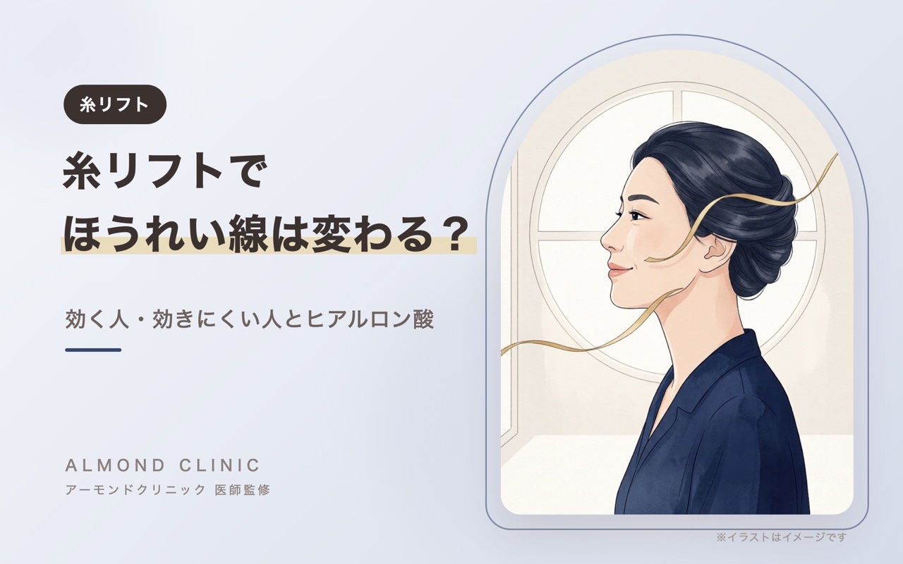 糸リフトでほうれい線は変わる？効く人・効きにくい人とヒアルロン酸