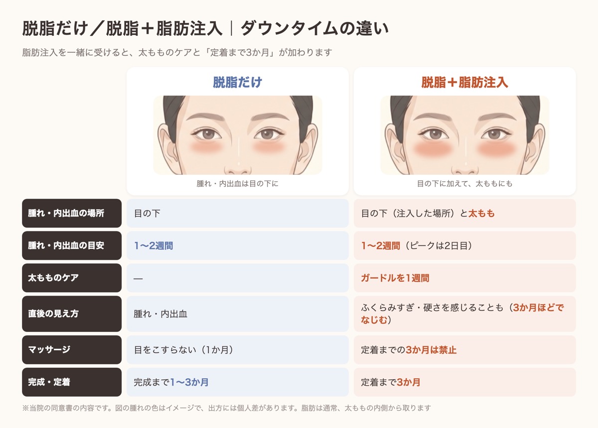 脱脂だけの場合と脱脂＋脂肪注入の場合のダウンタイム比較。太ももの腫れ、ガードル1週間、定着まで3か月の違い