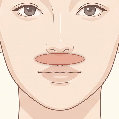 ガミーのボトックス注射の部位イラスト