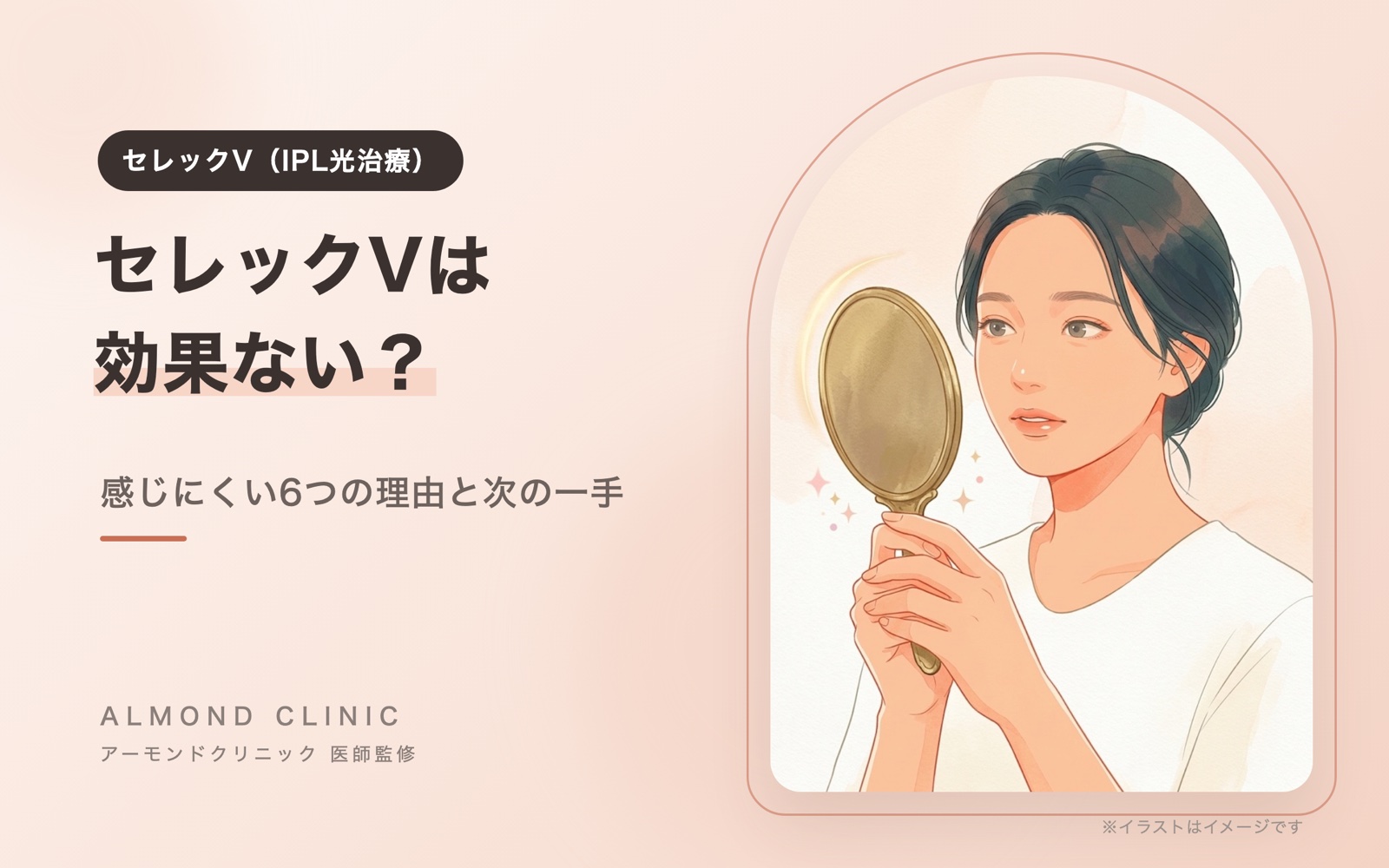 セレックV（IPL光治療）のコラムの表紙イラスト