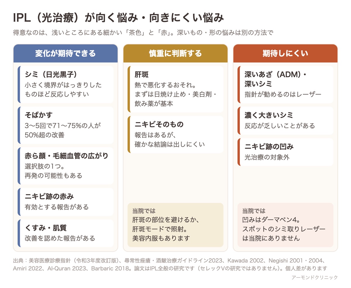 IPL光治療で変化が期待できる悩み・慎重に判断する悩み・期待しにくい悩みを3列に分けた一覧図