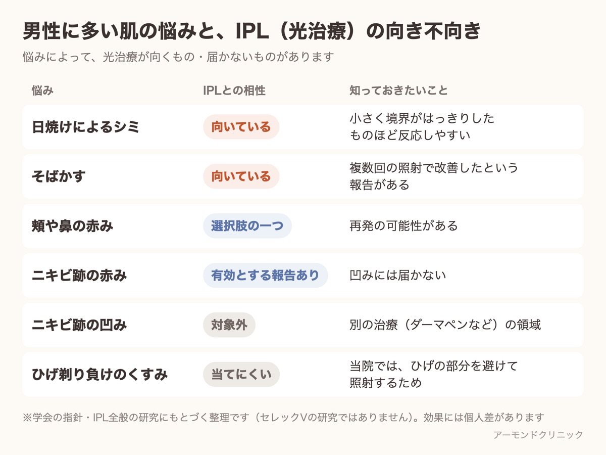 男性に多い肌の悩み（日焼けによるシミ・そばかす・赤み・ニキビ跡・ひげ剃り負けのくすみ）とIPL光治療の向き不向きをまとめた表