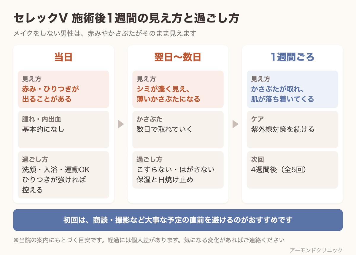 セレックV施術後の当日・翌日〜数日・1週間ごろの肌の見え方と過ごし方を3段階で示した図