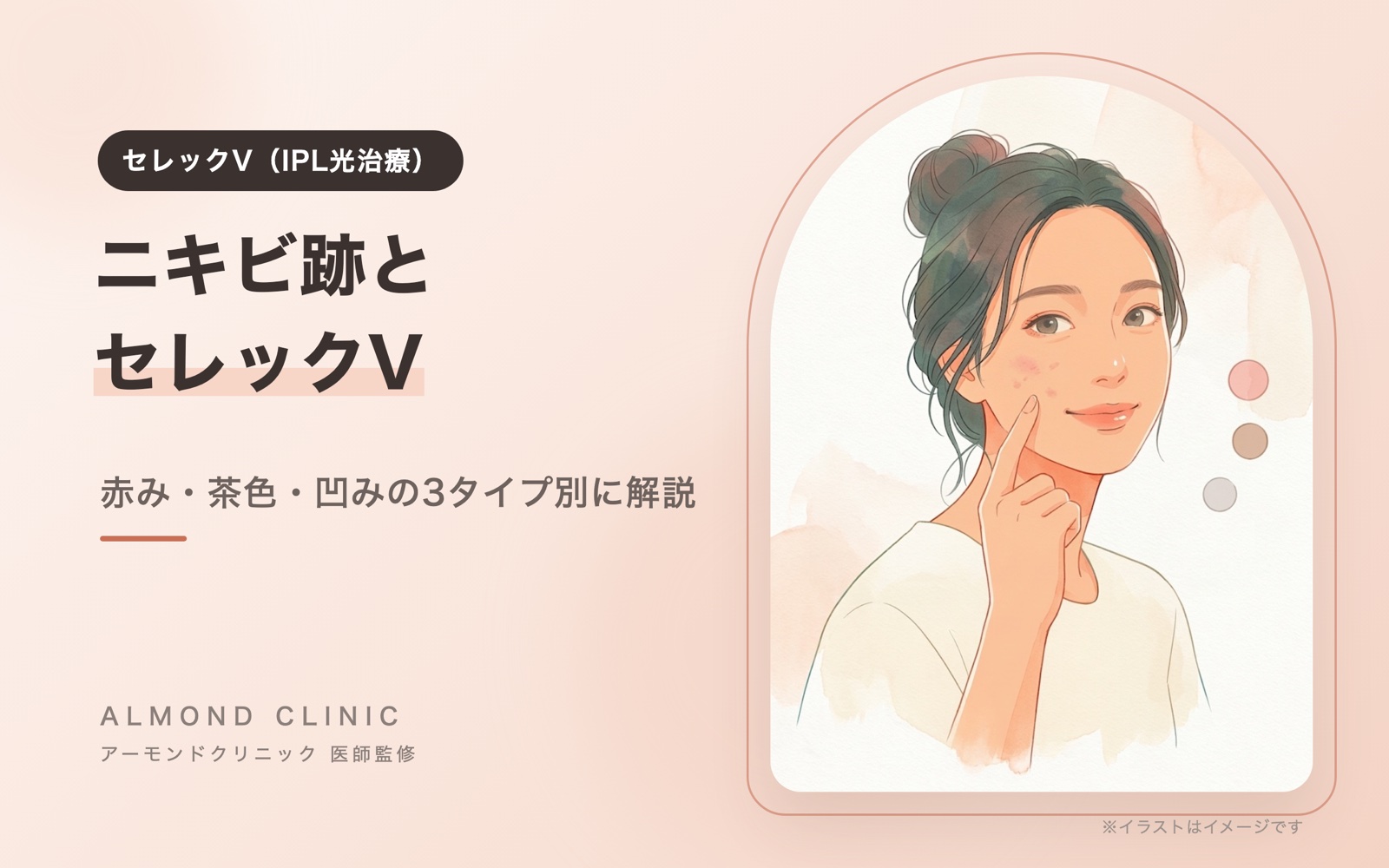 セレックV(IPL光治療)のコラムの表紙イラスト