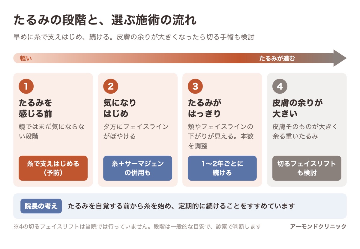 たるみを感じる前から皮膚の余りが大きい段階までの4段階と、早めの糸から始めて続け、重くなったら切るフェイスリフトも検討する流れの図