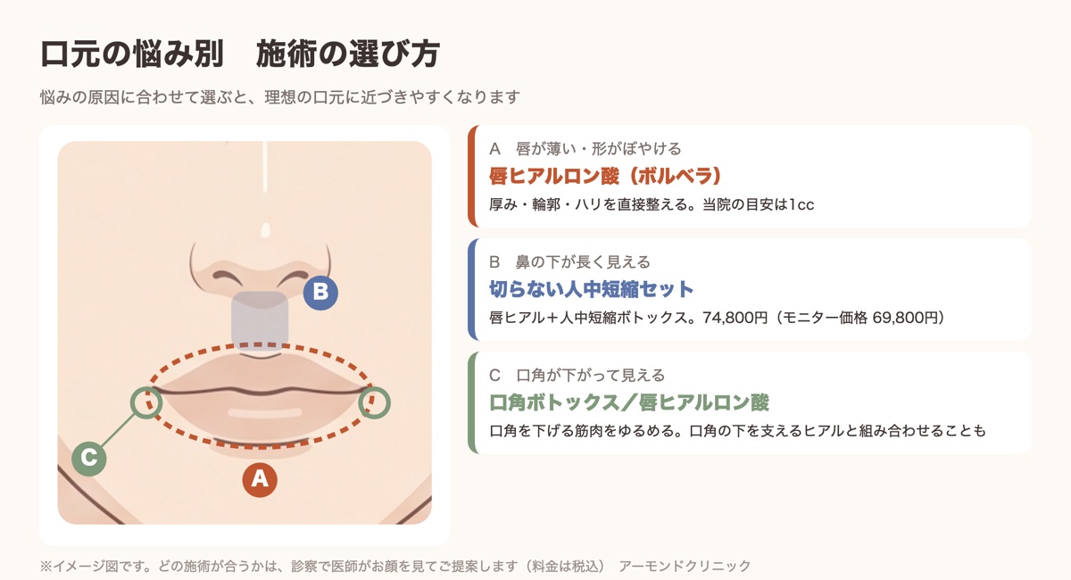 口元の悩み別に唇ヒアルロン酸・人中短縮・口角ボトックスの選び方を示した図