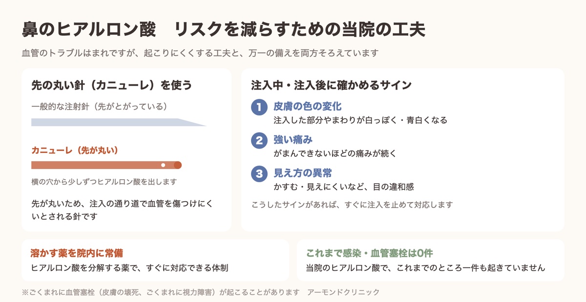鼻のヒアルロン酸でリスクを減らすための当院の工夫（カニューレと確認するサイン）の図